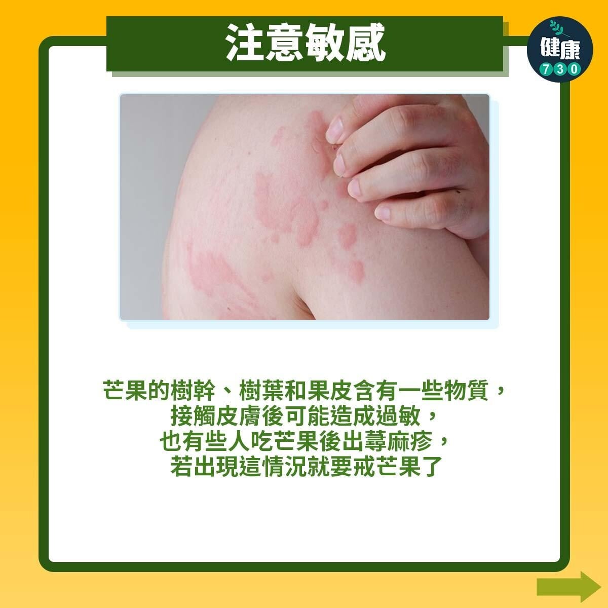 注意敏感
